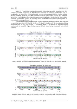 Detection of Real Time QRS Complex Using Wavelet Transform | PDF