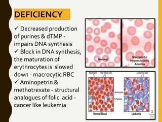 DEFICIENCY
 Decreased production
of purines & dTMP -
impairs DNA synthesis
 Block in DNA synthesis,
the maturation of
erythrocytes is slowed
down - macrocytic RBC
 Aminopetrin &
methotrexate - structural
analogues of folic acid -
cancer like leukemia
 