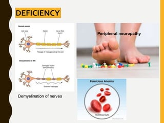 DEFICIENCY
Demyelination of nerves
Peripheral neuropathy
 