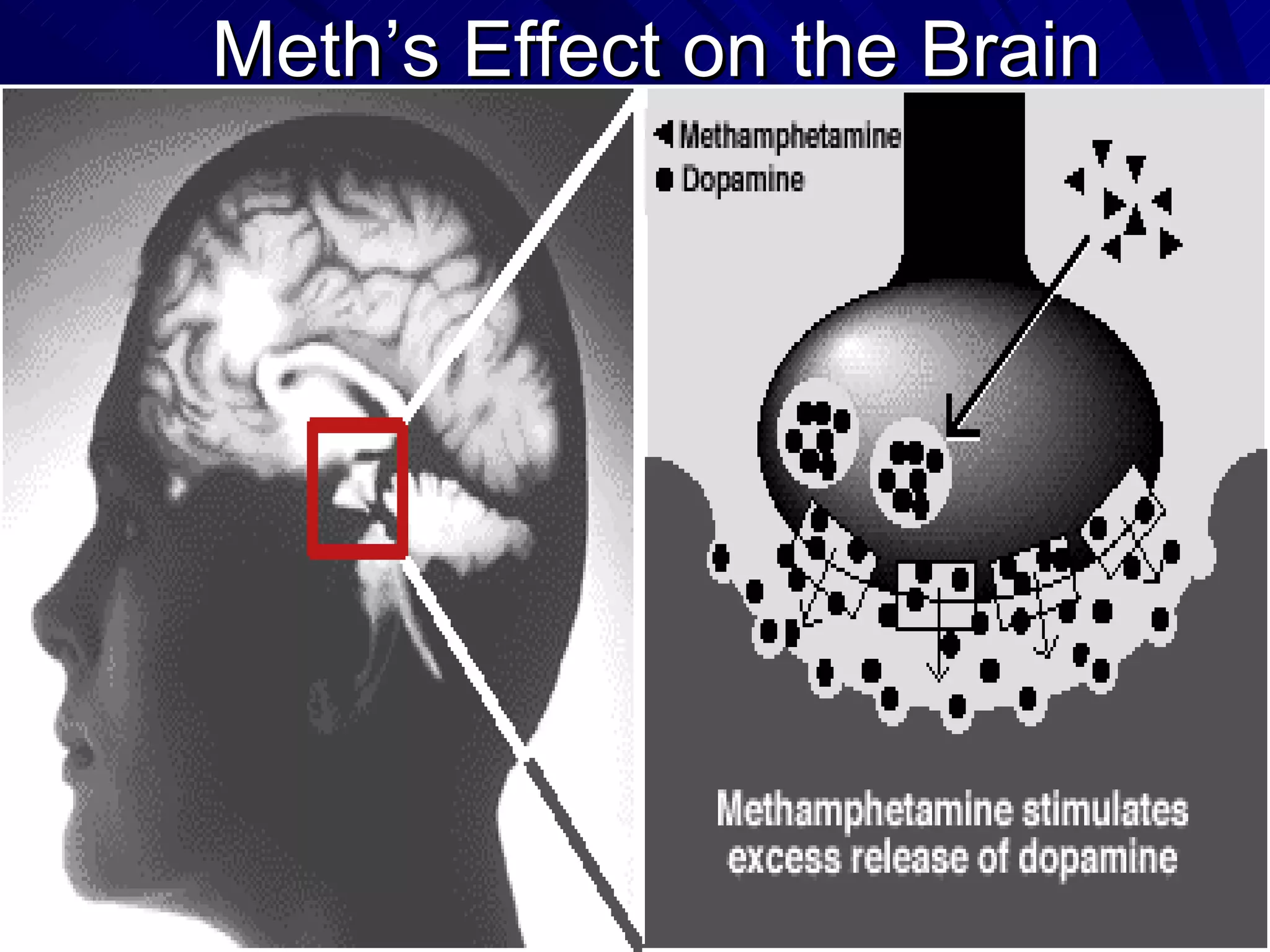 Meth’s Effect on the Brain 