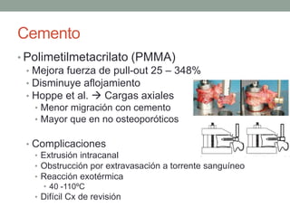 Cemento
• Polimetilmetacrilato (PMMA)
• Mejora fuerza de pull-out 25 – 348%
• Disminuye aflojamiento
• Hoppe et al.  Cargas axiales
• Menor migración con cemento
• Mayor que en no osteoporóticos
• Complicaciones
• Extrusión intracanal
• Obstrucción por extravasación a torrente sanguíneo
• Reacción exotérmica
• 40 -110ºC
• Difícil Cx de revisión
 
