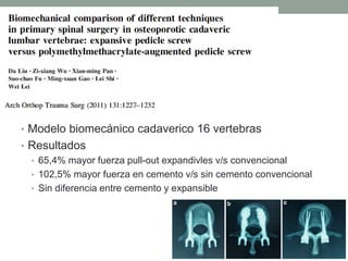 • Modelo biomecánico cadaverico 16 vertebras
• Resultados
• 65,4% mayor fuerza pull-out expandivles v/s convencional
• 102,5% mayor fuerza en cemento v/s sin cemento convencional
• Sin diferencia entre cemento y expansible
 