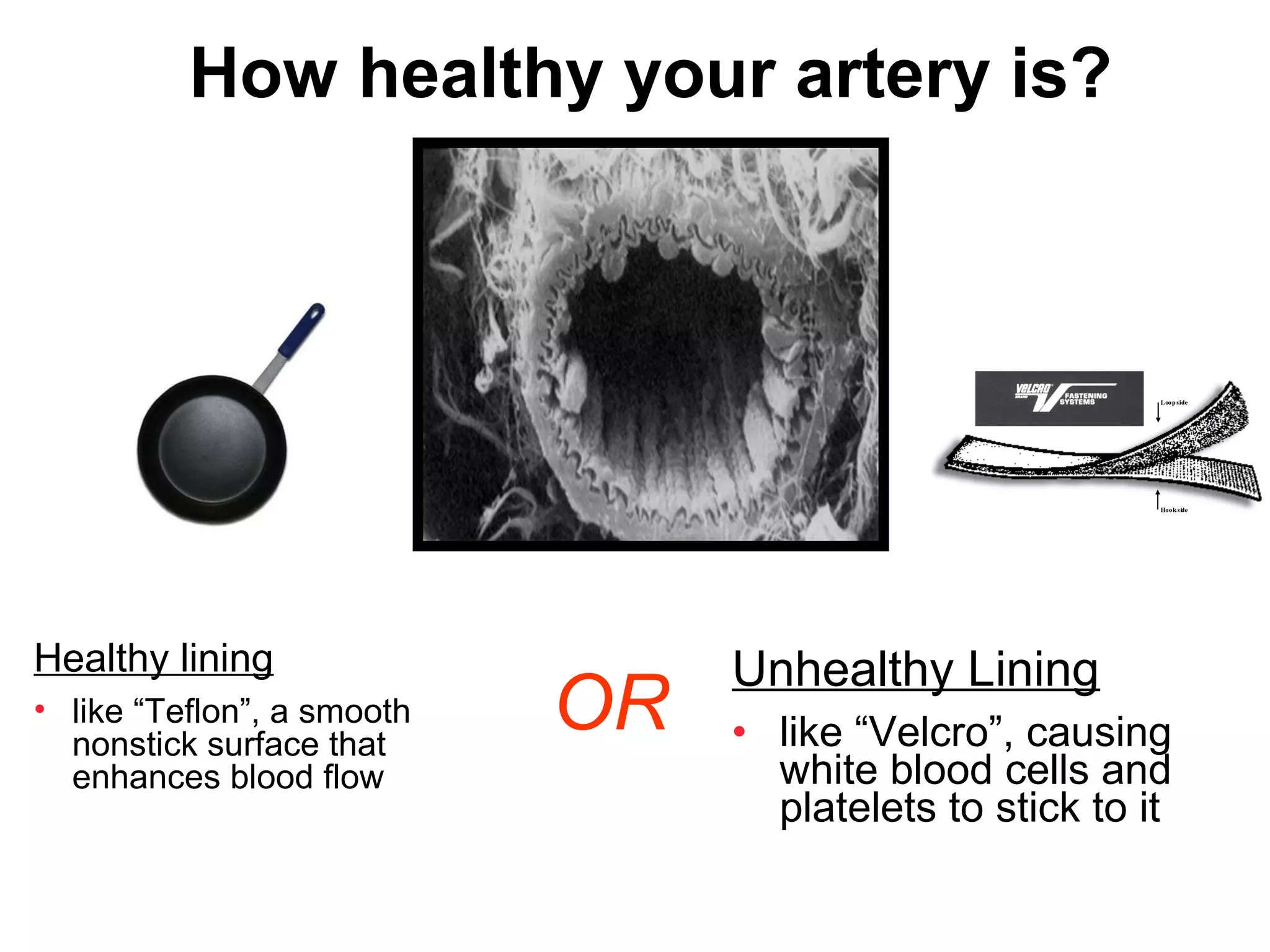 How healthy your artery is?




Healthy lining                   Unhealthy Lining
• like “Teflon”, a smooth
  nonstick surface that
                            OR   • like “Velcro”, causing
  enhances blood flow              white blood cells and
                                   platelets to stick to it
 