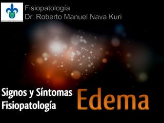 Fisiopatología Dr. Roberto Manuel Nava Kuri Edema Signos y Síntomas Fisiopatología 