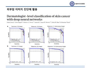 피부암 이미지 진단에 활용
 