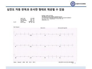심전도 자동 판독과 유사한 형태로 제공될 수 있음
 