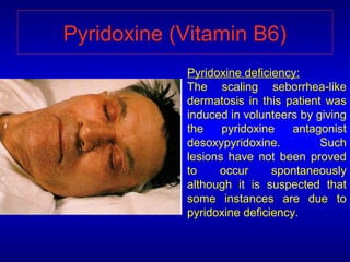 Vitamin B6 Deficiency Diseases