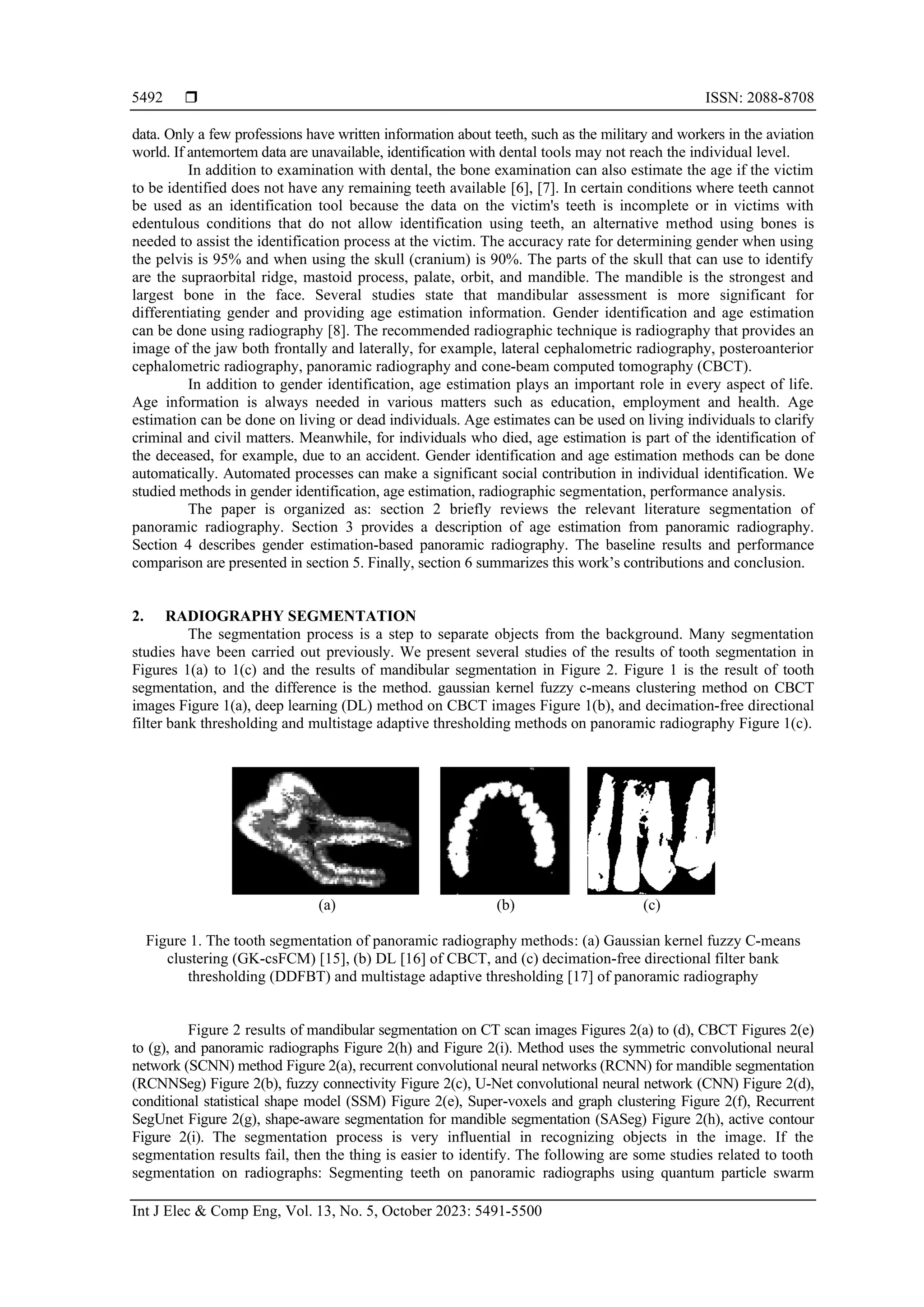 System of gender identification and age estimation from radiography: a ...