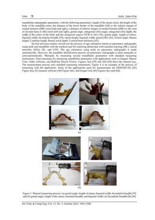 System of gender identification and age estimation from radiography: a ...