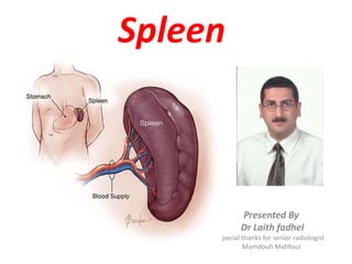 Spleen
Presented By
Dr Laith fadhel
Special thanks for senior radiologist
Mamdouh Mahfouz