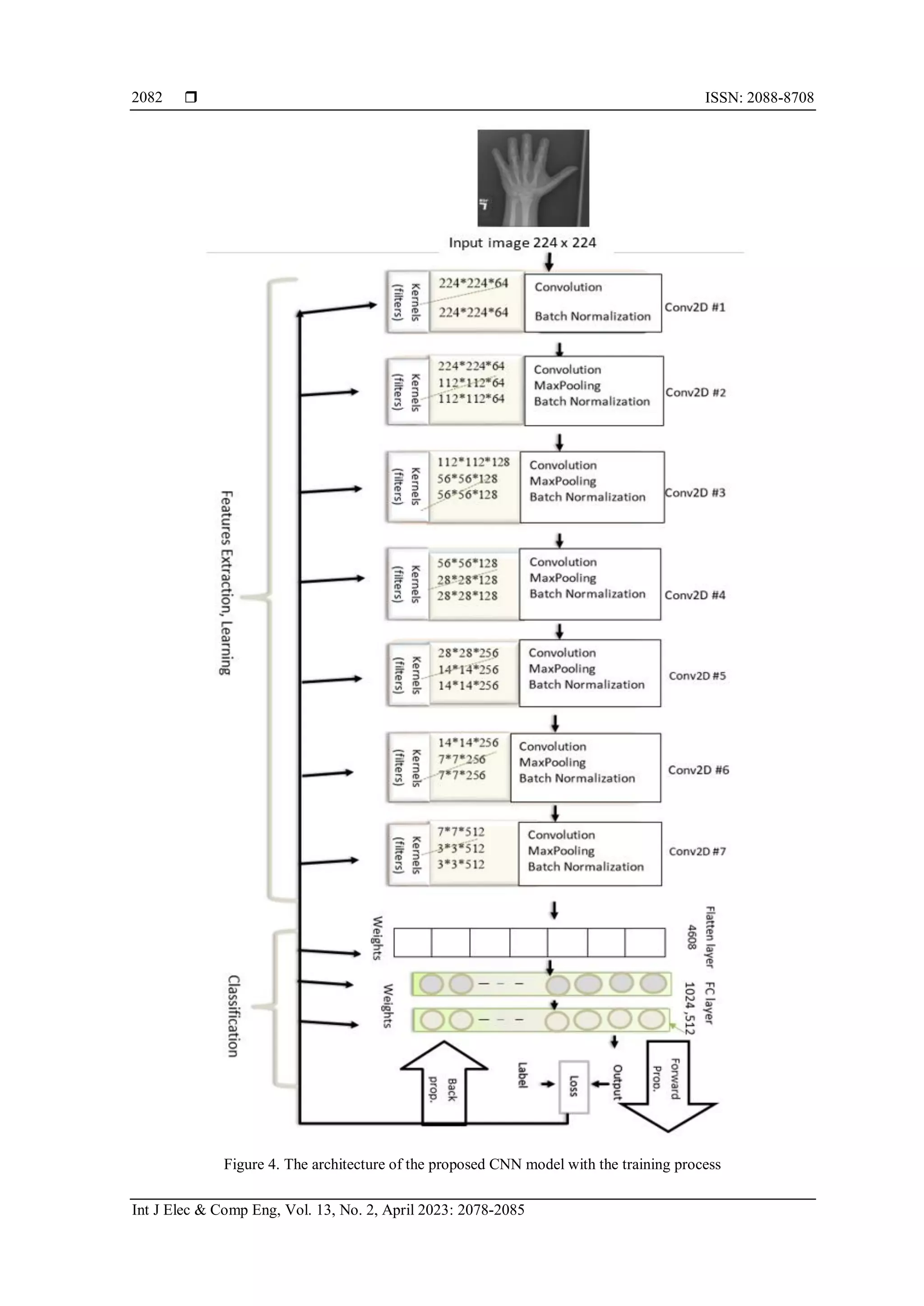 Bone age assessment based on deep learning architecture | PDF