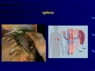 spleen
 