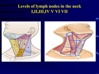 Levels of lymph nodes in the neck
I,II,III,IV V VI VII
 