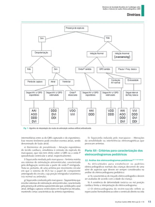 Diretrizes
Diretrizes da Sociedade Brasileira de Cardiologia sobre
Análise e Emissão de Laudos Eletrocardiográficos 2009
Arq Bras Cardiol 2009; 93(3 supl.2): 1-19
Fig. 1 - Algoritmo de interpretação dos modos de estimulação cardíaca artificial antibradicardia.
intermediárias entre as do QRS capturado e do espontâneo.
Esse mesmo fenômeno pode envolver eventos atriais, sendo
denominado de fusão atrial;
e) Batimentos de pseudofusão - Ativação espontânea
do tecido cardíaco, simultânea à emissão da espícula do
marcapasso, que não tem efeito sobre o QRS ou a onda P
(pseudofusão ventricular e atrial, respectivamente);
f) Taquicardia mediada pelo marcapasso - Arritmia restrita
aos sistemas de estimulação atrioventricular, caracterizada
pela deflagração ventricular a partir de onda P retrógrada.
Trata-se, portanto, de uma arritmia por movimento circular
em que o sistema de ECA faz o papel de componente
anterógrado do circuito, cuja porção retrógrada é anatômica
(via normal ou anômala);
g) Taquicardia conduzida pelo marcapasso - Taquiarritmia que
envolve sistemas de estimulação atrioventricular, caracterizada
pelapresençadearritmiasupraventricularque,sentidapelocanal
atrial, deflagra capturas ventriculares em frequências elevadas,
mantendo certas características da arritmia espontânea;
h) Taquicardia induzida pelo marcapasso - Alterações
da sensibilidade ou interferências eletromagnéticas que
provocam arritmias.
Parte XII - Critérios para caracterização dos
eletrocardiogramas pediátricos
12. Análise dos eletrocardiogramas pediátricos76,77,78,79,80,81
As dificuldades para estabelecer os padrões
eletrocardiográficos normais das crianças decorrem de uma
série de aspectos que devem ser sempre considerados na
análise do eletrocardiograma pediátrico:
a) As características do traçado eletrocardiográfico devem
ser avaliadas de acordo com a idade da criança;
b) A existência de deformidade torácica ou má posição
cardíaca limita a interpretação do eletrocardiograma;
c) O eletrocardiograma do recém-nascido reflete as
repercussões hemodinâmicas sobre o ventrículo direito na vida
13
diretriz_ECG.indd 13 25/8/2009 10:00:57
 