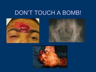 DON’T TOUCH A BOMB! 