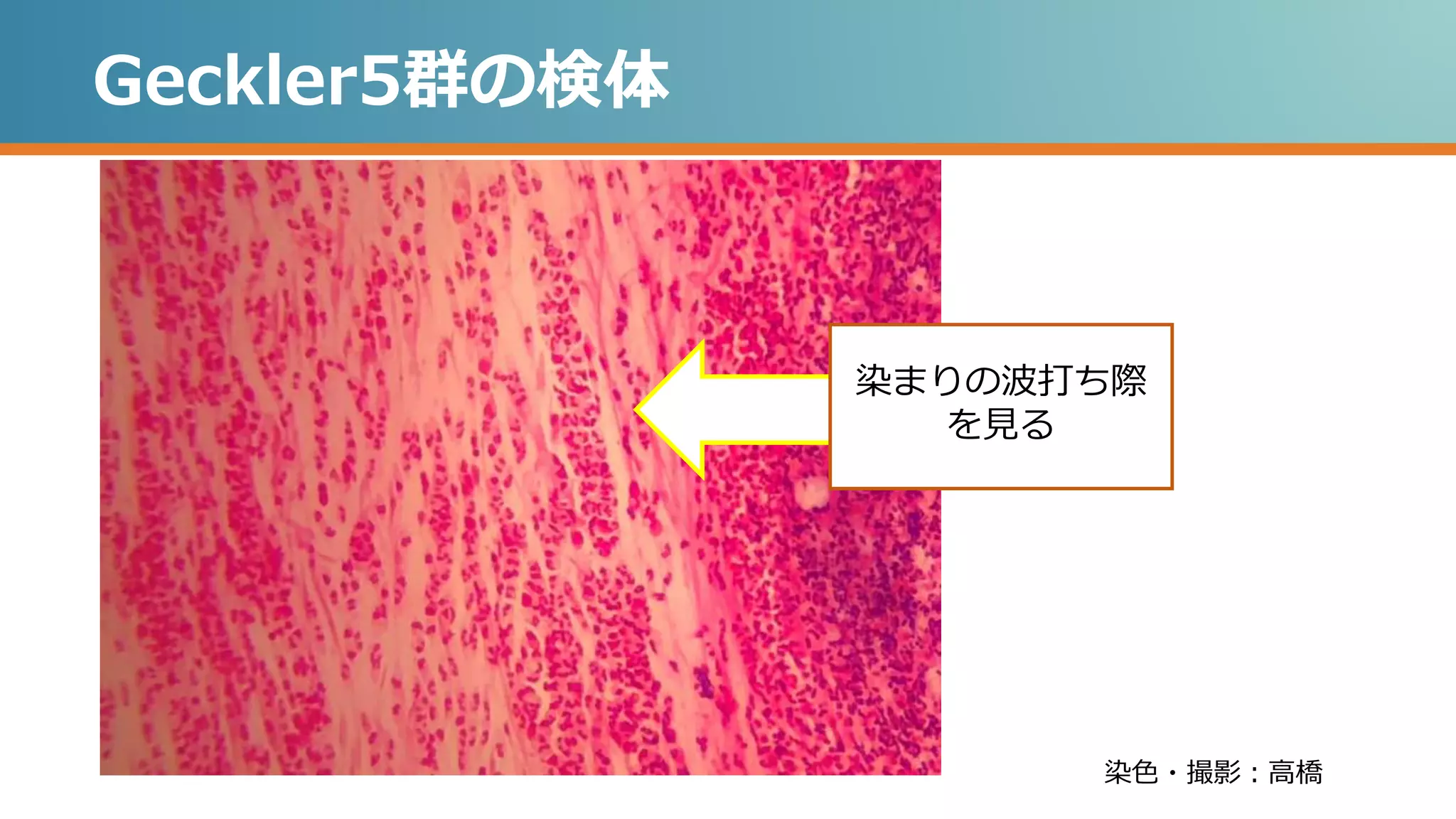 Geckler5群の検体
染色・撮影：高橋
染まりの波打ち際
を見る
 
