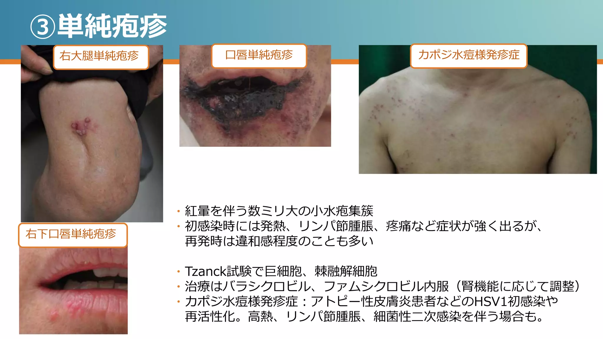 皮膚所見の鑑別 皮膚科医へのコンサルタント【ADVANCED】 | PPTX