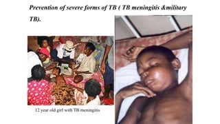 Prevention of severe forms of TB ( TB meningitis &military
TB).
12 year old girl with TB meningitis
 