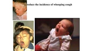 reduce the incidence of whooping cough
.
 