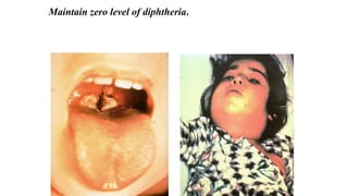 Maintain zero level of diphtheria.
 