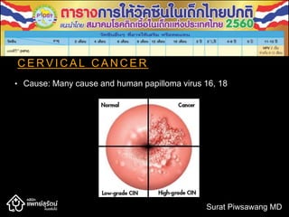 C E R V I C A L C A N C E R
• Cause: Many cause and human papilloma virus 16, 18
Surat Piwsawang MD
 