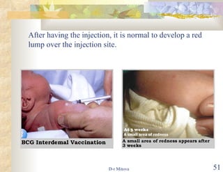After having the injection, it is normal to develop a red lump over the injection site. 