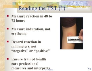 Reading the TST (1) Measure reaction in 48 to 72 hours Measure induration, not erythema Record reaction in millimeters, not “negative” or “positive” Ensure trained health care professional measures and interprets the TST 