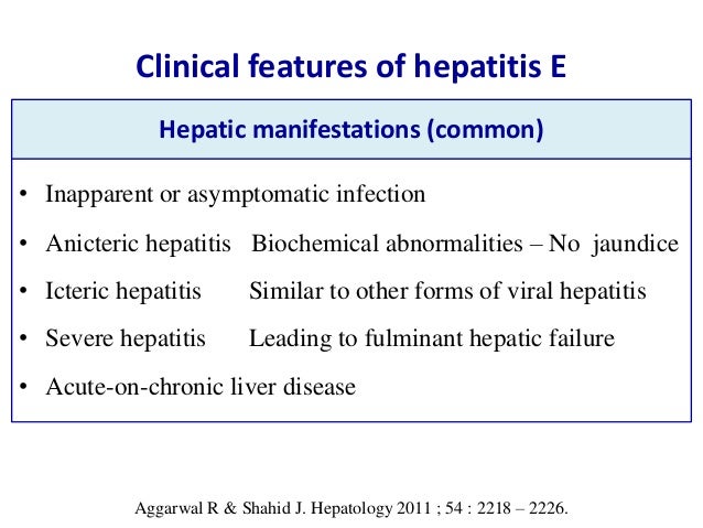 Anicteric Viral Hepatitis | Anicteric Viral Hepatitis – WXCQRB