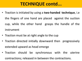 VACCUM ASSISTED DELIVERY | PPT