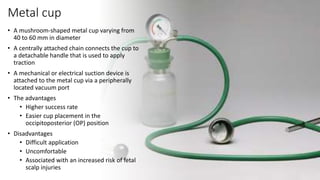 Metal cup
• A mushroom-shaped metal cup varying from
40 to 60 mm in diameter
• A centrally attached chain connects the cup to
a detachable handle that is used to apply
traction
• A mechanical or electrical suction device is
attached to the metal cup via a peripherally
located vacuum port
• The advantages
• Higher success rate
• Easier cup placement in the
occipitoposterior (OP) position
• Disadvantages
• Difficult application
• Uncomfortable
• Associated with an increased risk of fetal
scalp injuries
 