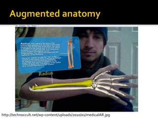 Augmented anatomyhttp://technoccult.net/wp-content/uploads/2010/01/medicalAR.jpg