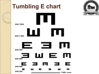 Tumbling E chart
 