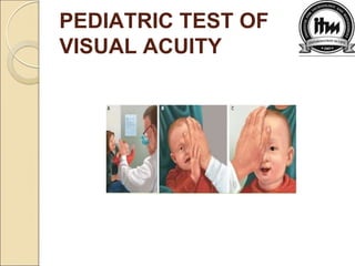 PEDIATRIC TEST OF
VISUAL ACUITY
 