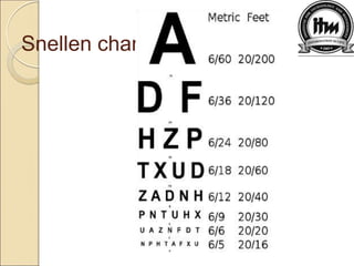 Snellen chart
 
