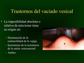 Trastornos del vaciado vesical
• La imposibilidad absoluta o
relativa de miccionar tiene
su origen en:
– Disminución de la
contractilidad de la vejiga.
– Incremento de la resistencia
de la unión vesicouretral.
– Ambas.

 