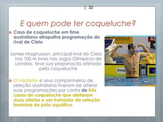 E quem pode ter coqueluche?
 Caso de coqueluche em time
australiano atrapalha programação de
rival de Cielo
James Magnussen, principal rival de Cielo
nos 100 m livres nos Jogos Olímpicos de
Londres, teve sua preparação afetada
pela coqueluche
 O nadador e seus companheiros de
seleção australiana tiveram de alterar
suas programações por conta de três
casos de coqueluche que afetaram
duas atletas e um treinador da seleção
feminina de pólo aquático.
| 32
 