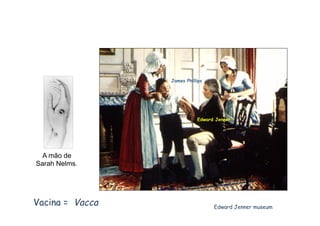 Edward Jenner museum
Edward Jenner
James Phillips
Vacina = Vacca
A mão de
Sarah Nelms.
 