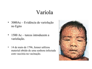 Varíola  3000Ac – Evidência de variolação no Egito 1500 Ac – turcos introduzem a variolação. 14 de maio de 1796, Jenner utilizou material obtido de uma senhora infectada com vaccinia na vacinação. 