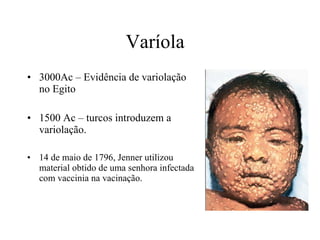 Varíola  3000Ac – Evidência de variolação no Egito 1500 Ac – turcos introduzem a variolação. 14 de maio de 1796, Jenner utilizou material obtido de uma senhora infectada com vaccinia na vacinação. 