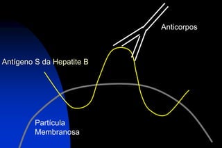 Antígeno S da Hepatite B
Partícula
Membranosa
Anticorpos
 