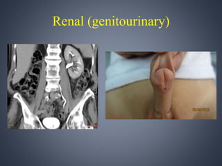 Renal (genitourinary) 
 