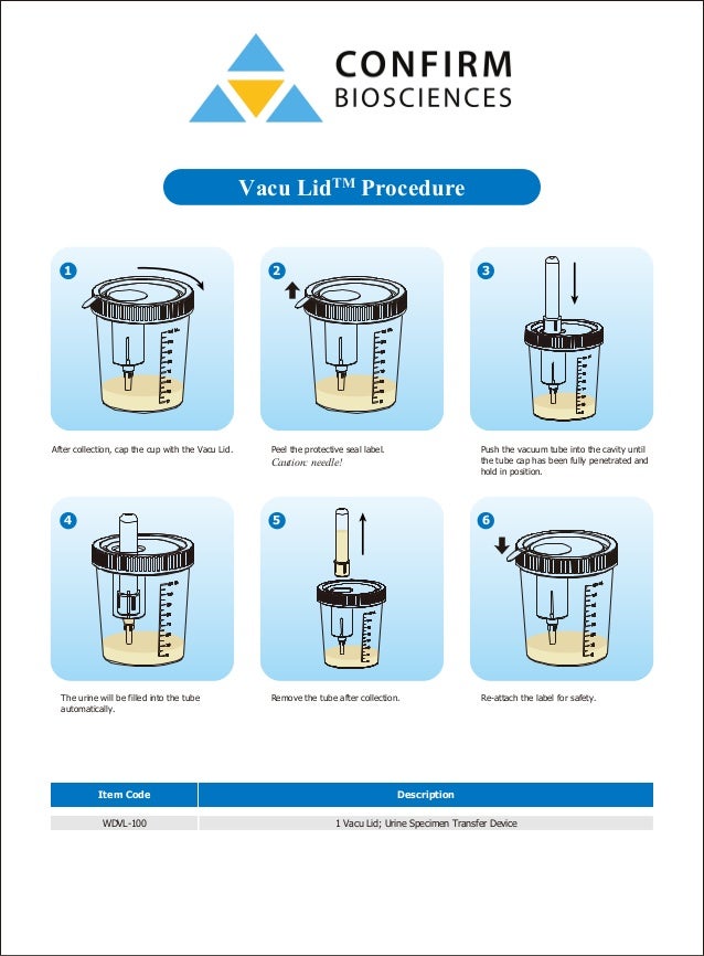 Vacu Lid Urine Specimen Transfer Device for Use With TCup Urine Drug…