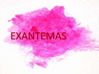 EXANTEMAS
 