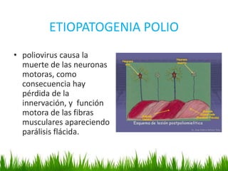 ETIOPATOGENIA POLIO
• poliovirus causa la
muerte de las neuronas
motoras, como
consecuencia hay
pérdida de la
innervación, y función
motora de las fibras
musculares apareciendo
parálisis flácida.
 