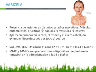 VARICELA
• Presencia de lesiones en distintos estadios evolutivos. Máculas
eritematosas, pruríticas → pápulas → vesículas → costras
• Aparecen primero en la cara, el tronco y el cuero cabelludo,
extendiéndose después por todo el cuerpo
• VACUNACION: Dos dosis 1a a los 12 a 15 m. La 2a a los 4 a 6 años
• MMR y MMRV son preparaciones disponibles. Se prefiere la
tetraviral en la administración a los 4 a 6 años.
 