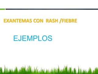 EXANTEMAS CON RASH /FIEBRE
EJEMPLOS
 
