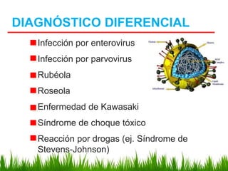 DIAGNÓSTICO DIFERENCIAL
Infección por enterovirus
Infección por parvovirus
Rubéola
Roseola
Enfermedad de Kawasaki
Síndrome de choque tóxico
Reacción por drogas (ej. Síndrome de
Stevens-Johnson)
 