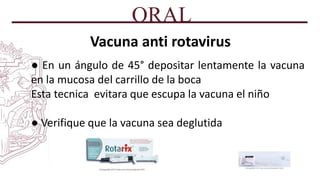 ORAL
Vacuna anti rotavirus
● En un ángulo de 45° depositar lentamente la vacuna
en la mucosa del carrillo de la boca
Esta tecnica evitara que escupa la vacuna el niño
● Verifique que la vacuna sea deglutida
 