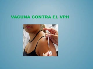 VACUNA CONTRA EL VPH
 