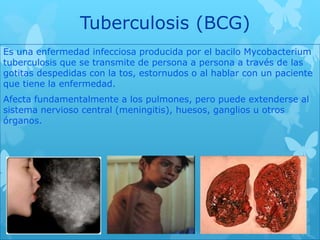 Tuberculosis (BCG)
Es una enfermedad infecciosa producida por el bacilo Mycobacterium
tuberculosis que se transmite de persona a persona a través de las
gotitas despedidas con la tos, estornudos o al hablar con un paciente
que tiene la enfermedad.
Afecta fundamentalmente a los pulmones, pero puede extenderse al
sistema nervioso central (meningitis), huesos, ganglios u otros
órganos.
 
